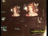 SYNDROME CHINOIS (LE) - THE CHINA SYNDROME
